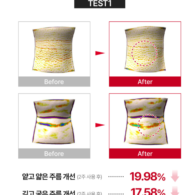 메디필 목주름 리들샷 넥스틱 미개봉