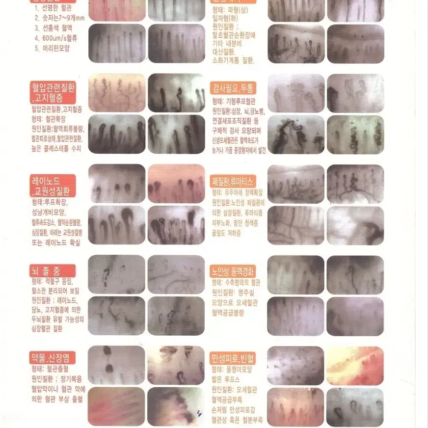 혈류개선 건강팔찌 토르마린 필히 네이버 검색