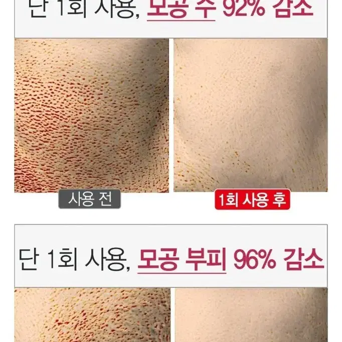 여드름 피지 좁쌀 모공에 효과좋은숯카마클렌저