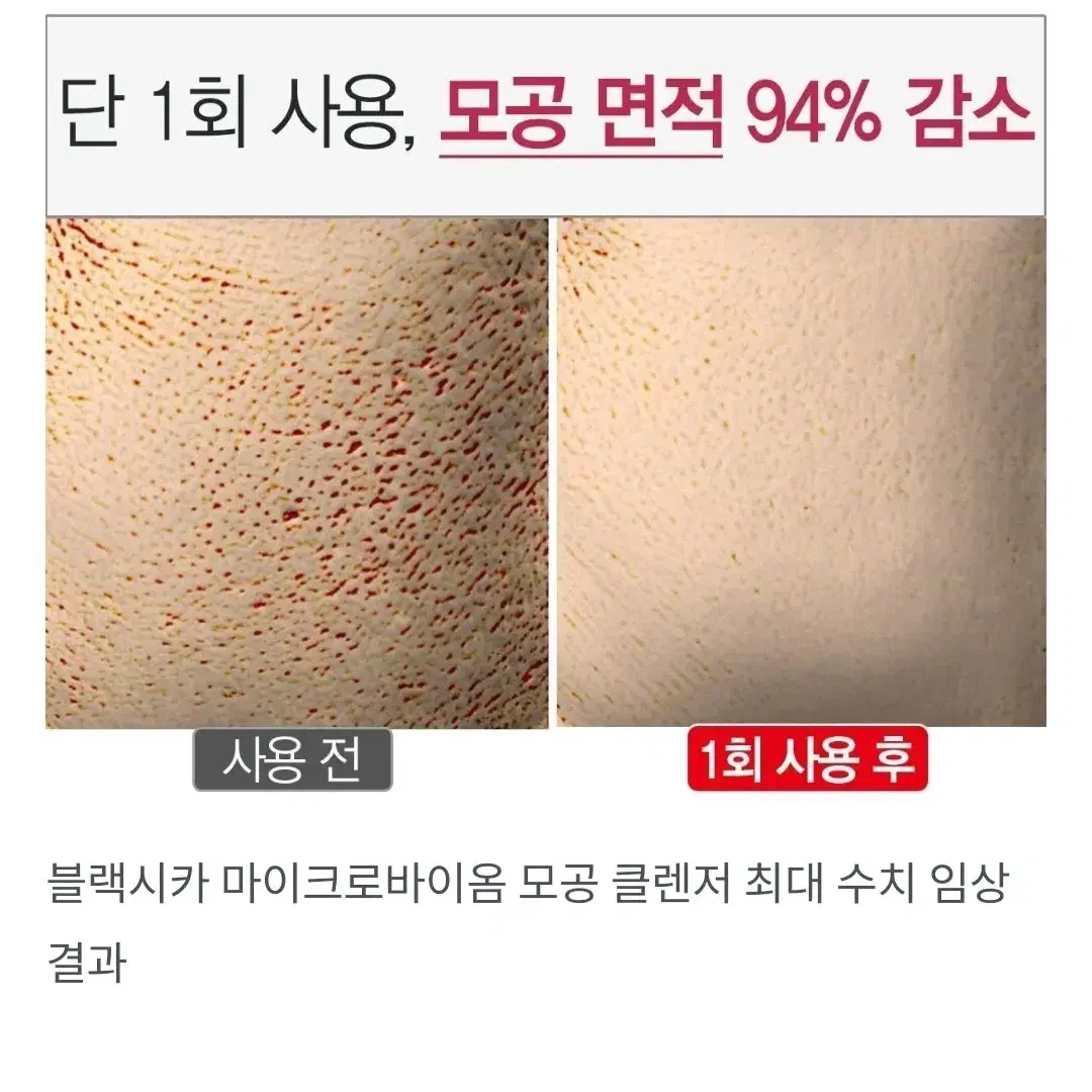 여드름 피지 좁쌀 모공에 효과좋은숯카마클렌저