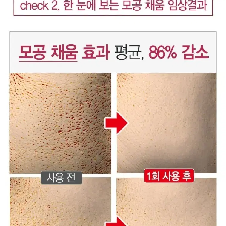 여드름 피지 좁쌀 모공에 효과좋은숯카마클렌저