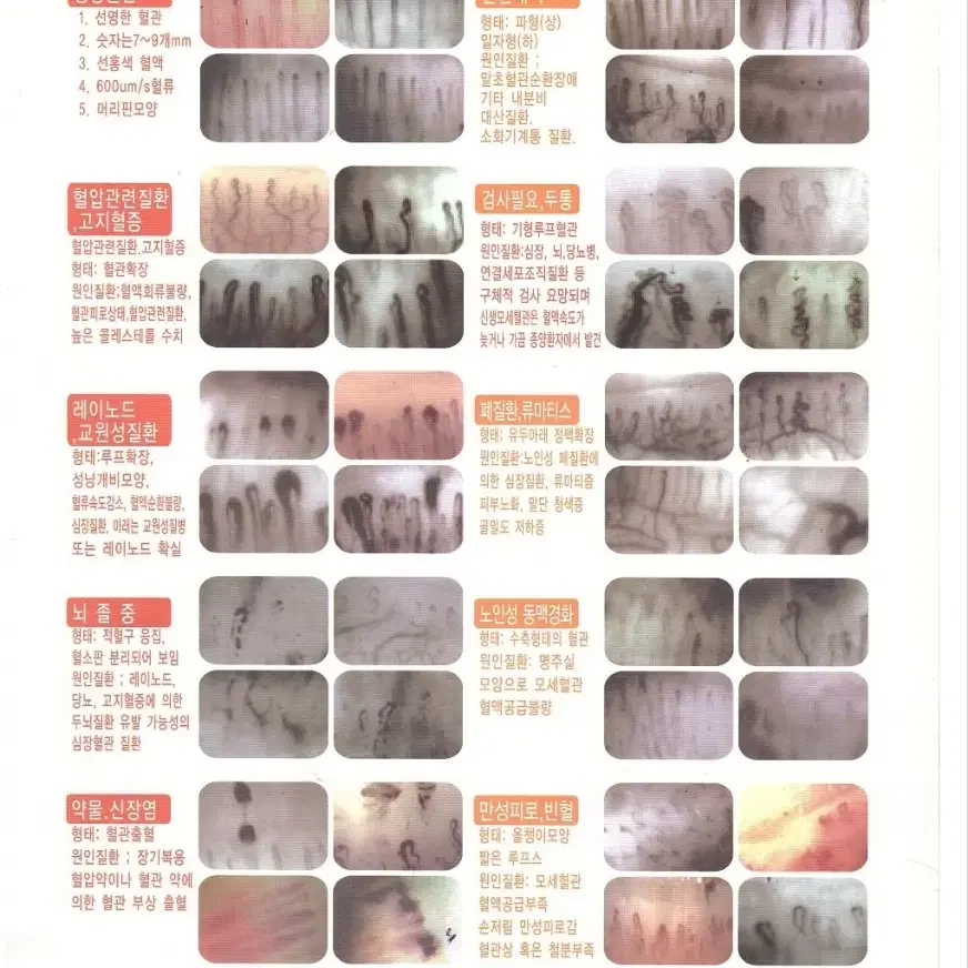 혈류개선 건강팔찌 토르마린 5주년 1+1 행사 12월31일까지