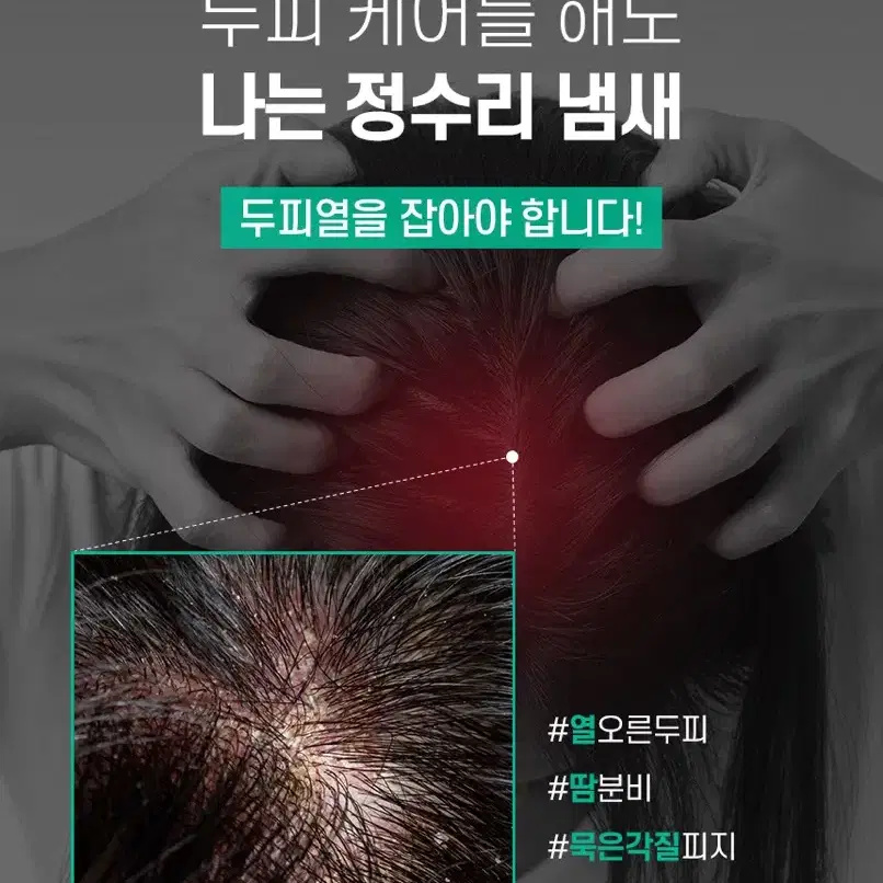 제이숲 카밍세라 정수리 냄새 두피팩