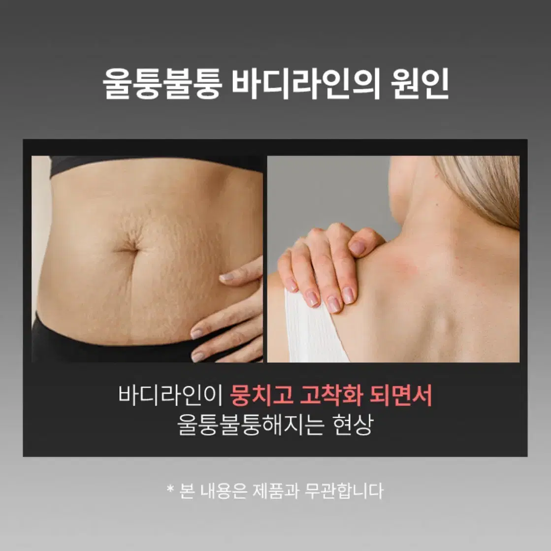 혼바디 디비엘샷 EMS고주파 저주파 온열 마사지기 + 부스터젤