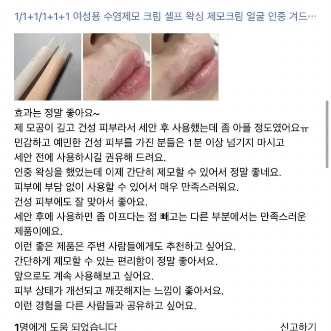 인중 제모 크림