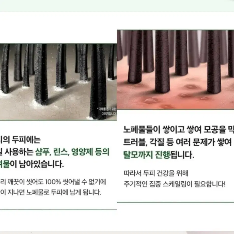 두피스케일링