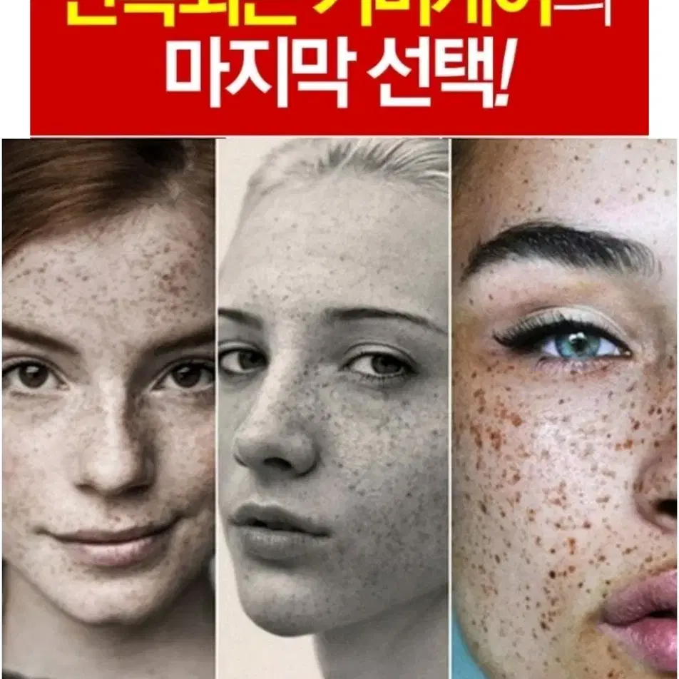 트라넥삼산 기미 검버섯 색소침착 미백 크림 착색 홍조주근깨 화장품