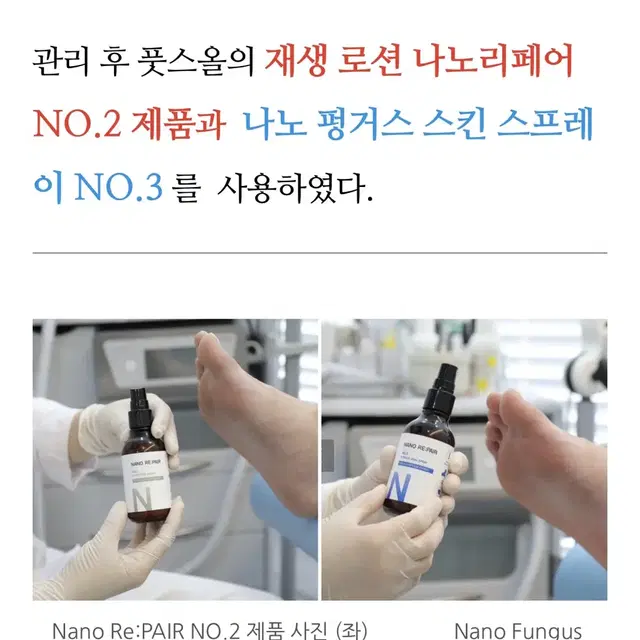 풋스올 No3.Fungus Skin Spray  나노 펑거스 스킨 스프레