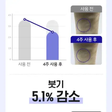 메디테라피 속살제로 EMS 새 상품 풀박스