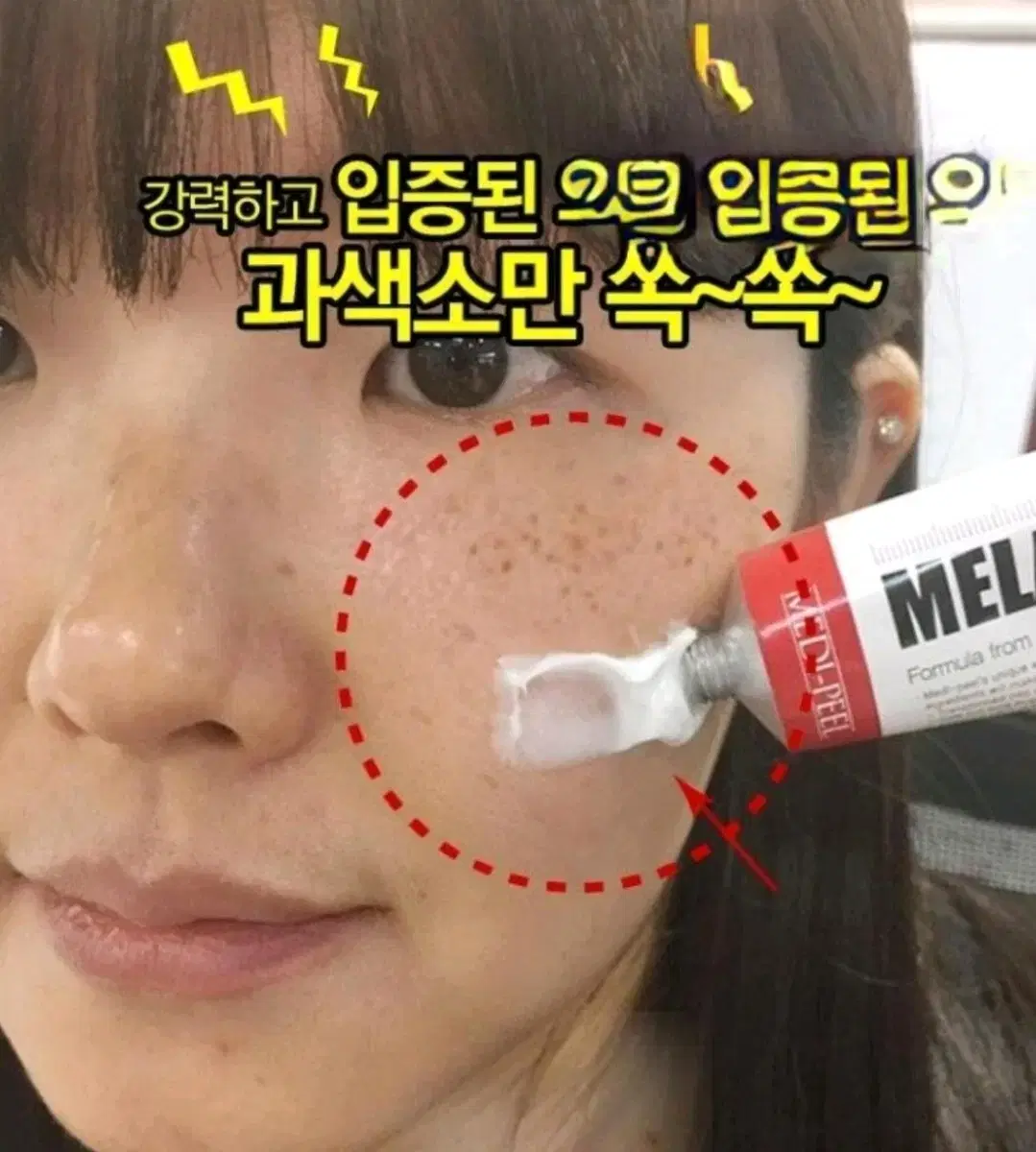 트라넥삼산 미백 기미 잡티검버섯색소침착주근깨홍조멜라논멜라토닝 화장품크림