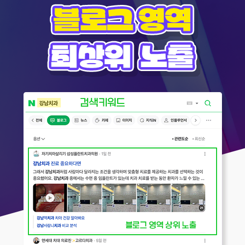 광고서비스