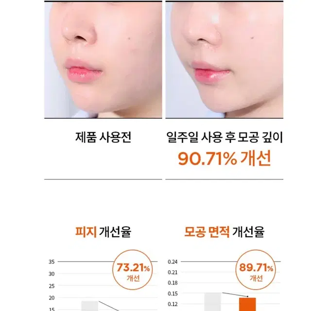 이즈앤트리 하이퍼 나이아신아마이드20 세럼