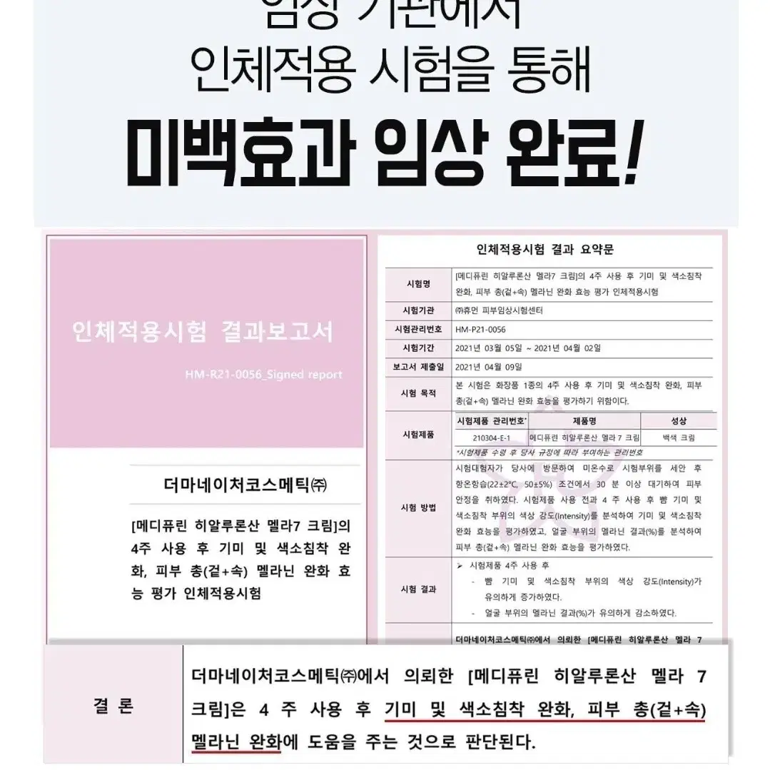 100%효과보장 토닝 레이저 필요X , 기미 주근깨 잡티 미백 기미 크림