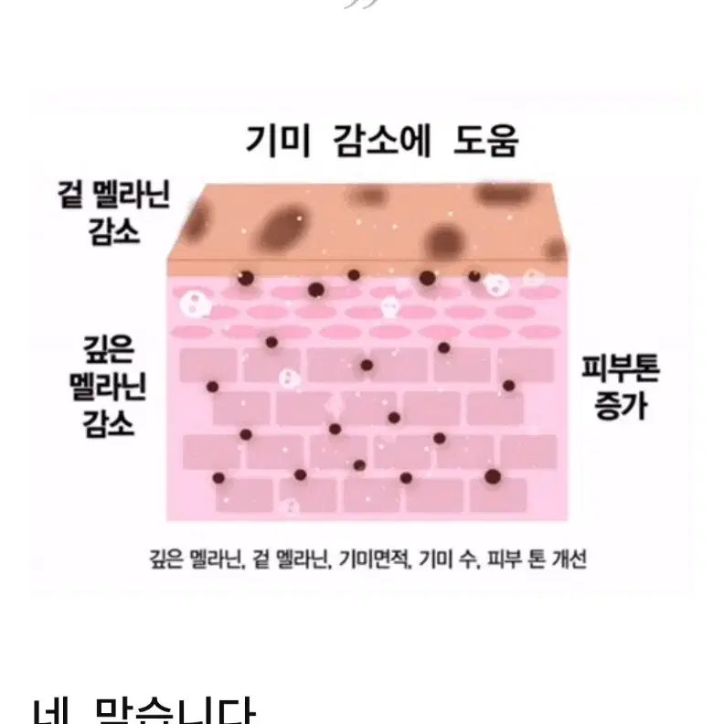 100%효과보장 토닝 레이저 필요X , 기미 주근깨 잡티 미백 기미 크림