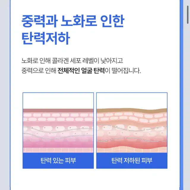 뷰플 딜링클 EMS 올인원 주름케어 디바이스