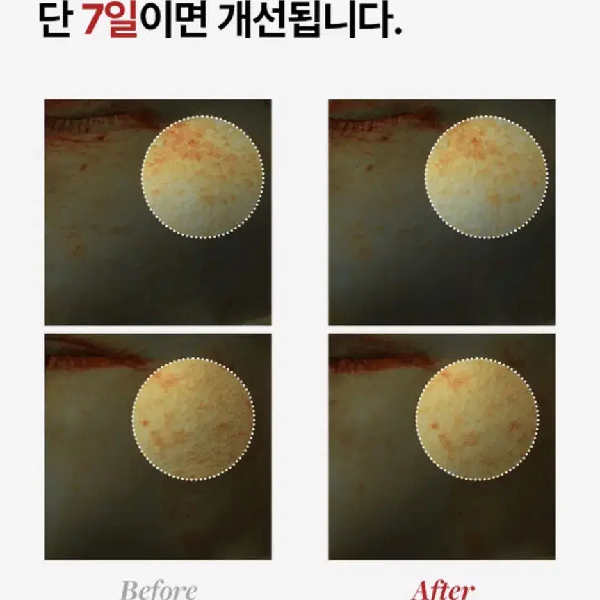 (미개봉)비타 리얼 토닝샷 앰플