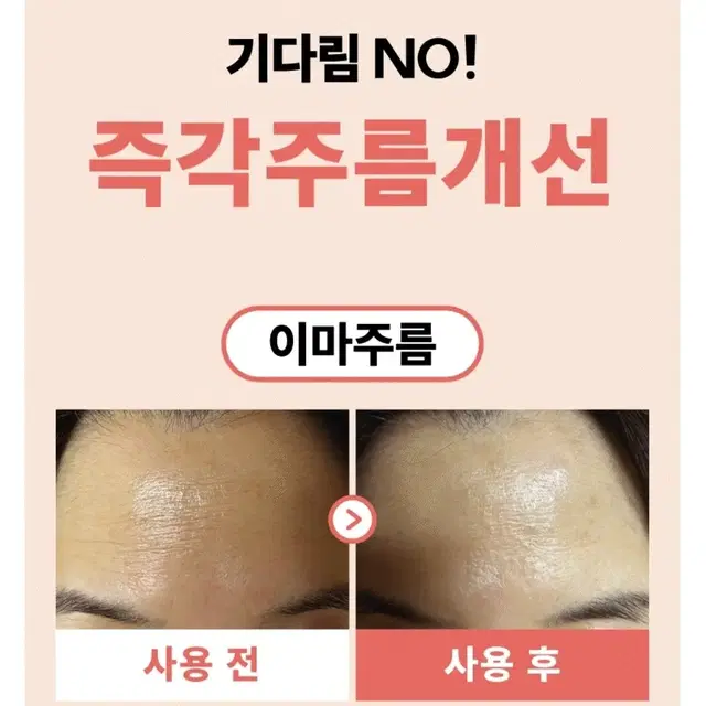 1회사용 주름개선 정제수0% 양파추출물 EGF 세레치피 앰플