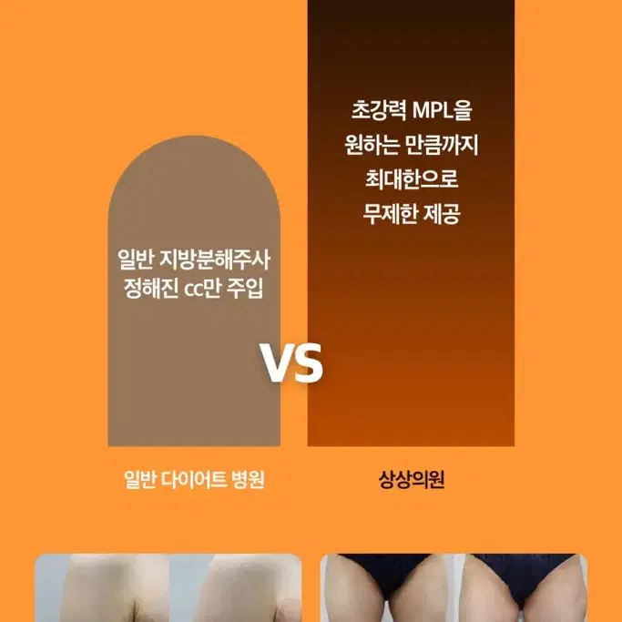 상상의원 대구점 mpl + 핏주사 총 부위별 8회