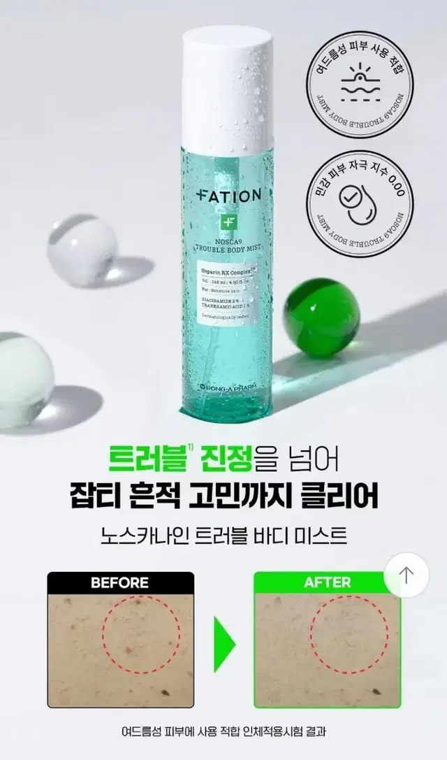 파티온 노스카나인 트러블 바디 미스트 145ml 새상품