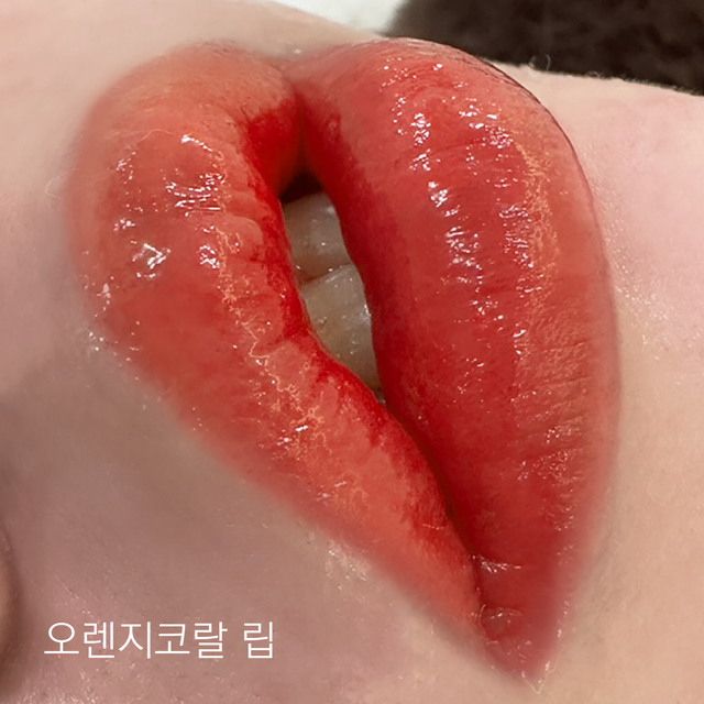 [잠실,송파,위례] 입술