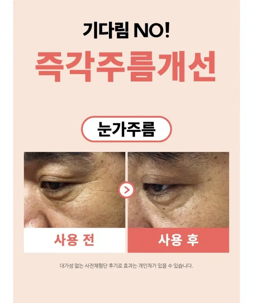 즉각주름개선 기다림No 초강력 항산화 쿼세틴 함유 수크랄페이트 앰플 세럼