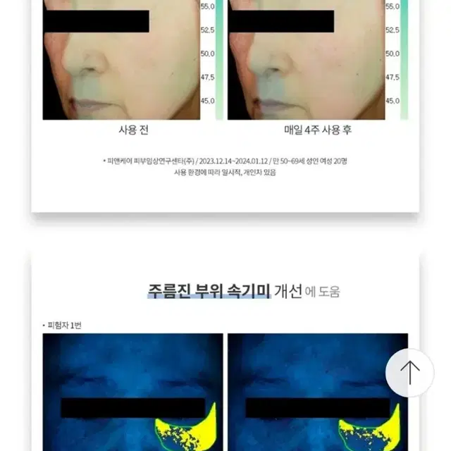 라비앙 EGF 마이크로핀 앰플 주름 기미 미백 마리오네뜨 목주름 리프팅