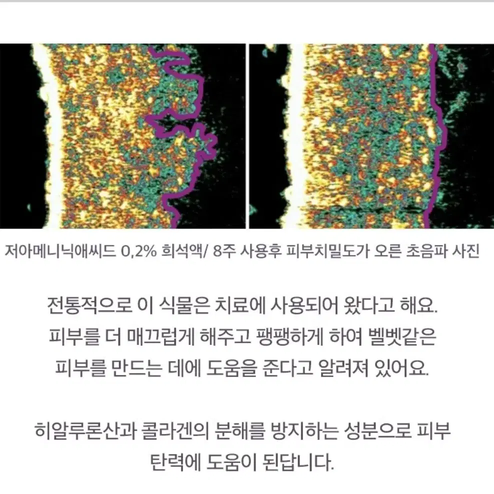 기미 잡티 미백 세니지아 유니크미 마이크로마이옴 세라마이드 리포좀 앰플