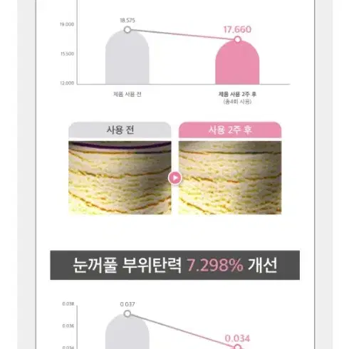 [3CP 이너필업] mts롤러 1개+에어리스 펌프 앰플 2개+수딩미스트