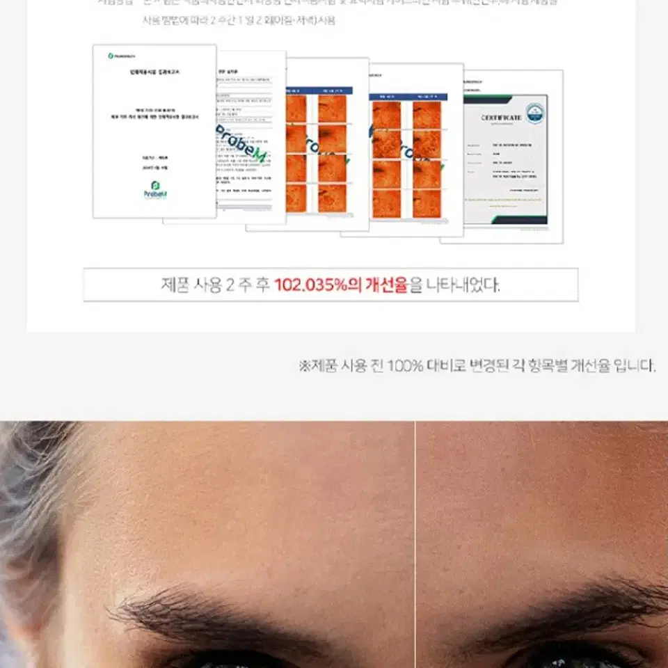 생얼 기미 크림 율피 보습 주름개선