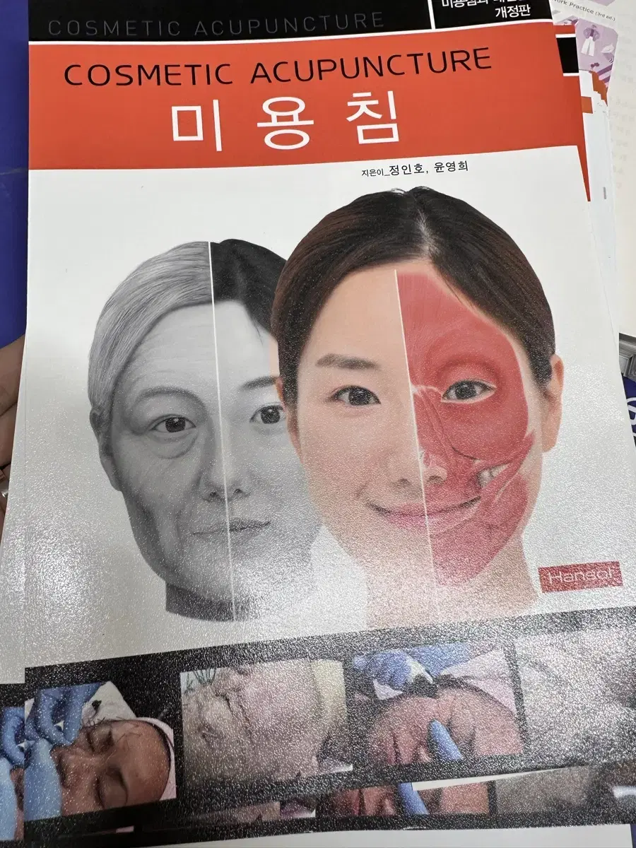 [새책] 미용침