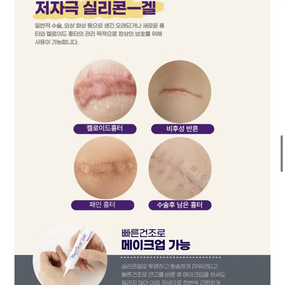 RemScar Gel 25g (흉터연고/새상품)