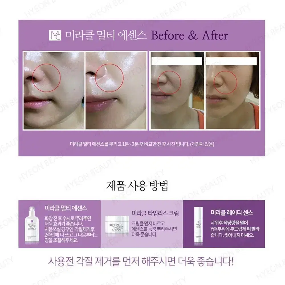 미라클 멀티 에센스 110ml 미백 주름개선 미스트 주름 관리 미백관리