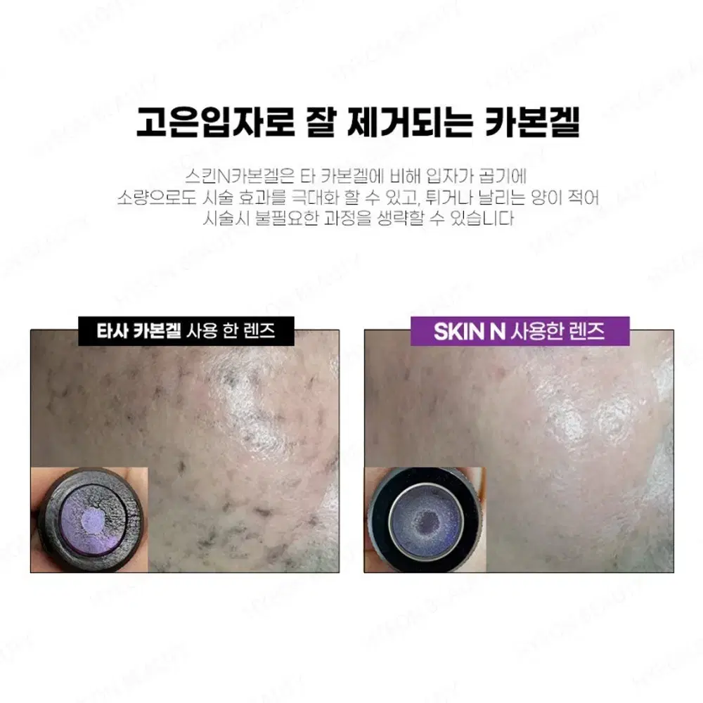 스킨 N 카본겔 레이져 스킨 크림 피부 윤기 카본겔 50g  레이져 시술