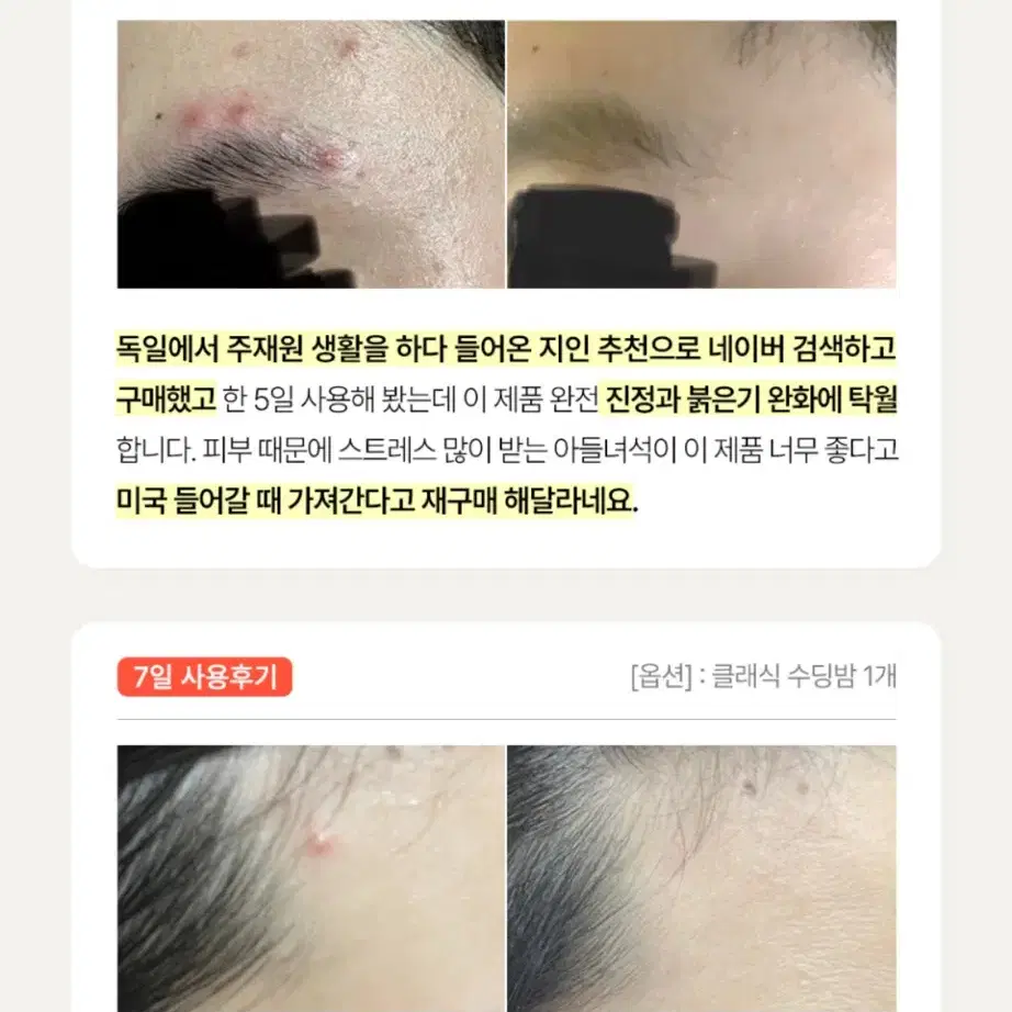 세라일론 클래식 수딩밤