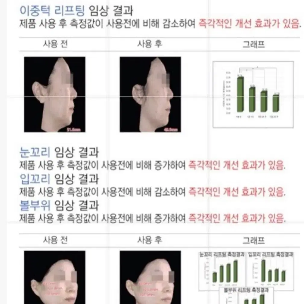 피부과X한번만발라도 효과팔자 주름 기미 탄력 줄기세포배양액 100% 앰플