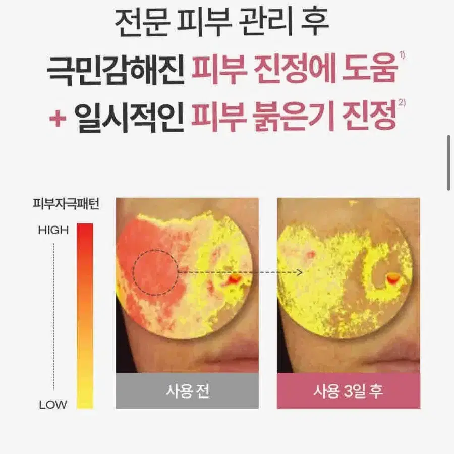 피지오겔 레드수딩 AI 민감성 크림