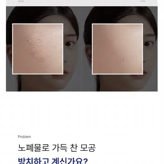 트렌디케어 아쿠아 모공힐러 새상품