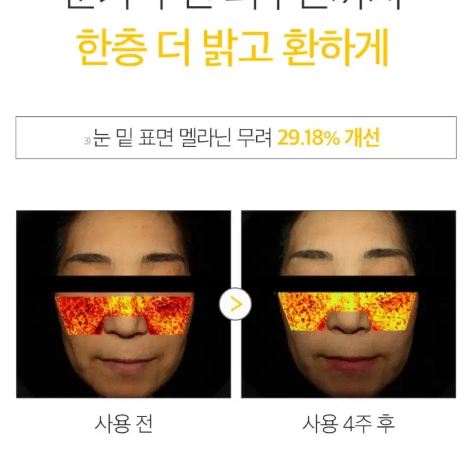 더마펌 펩트아이드 다크서클 크림 다크써클