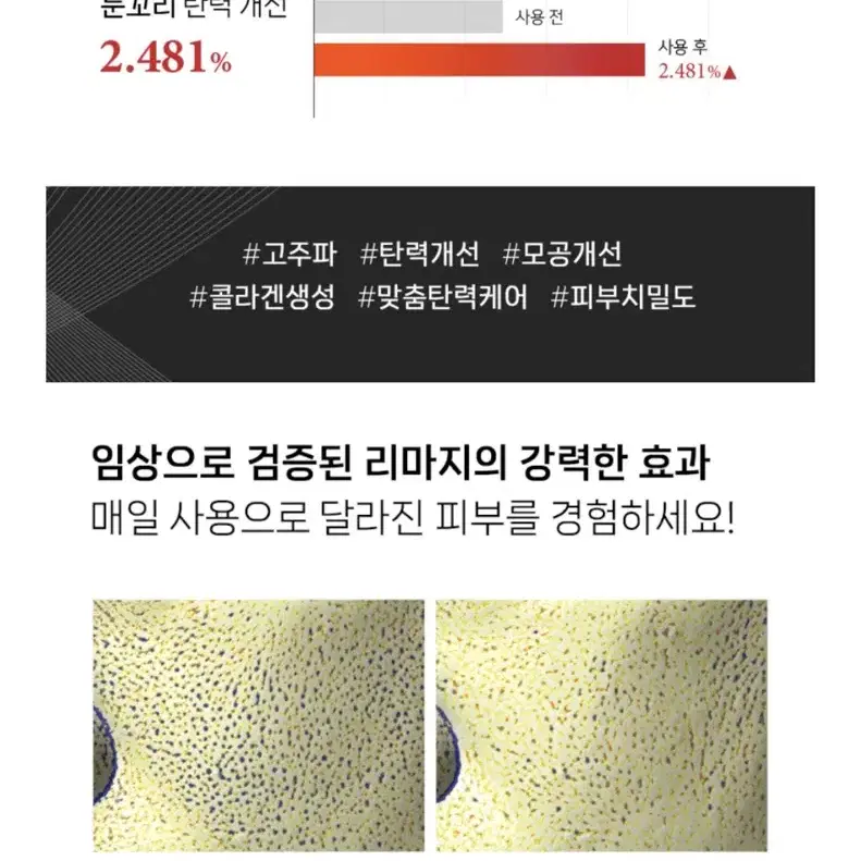 리클레어 리마지 고주파기기