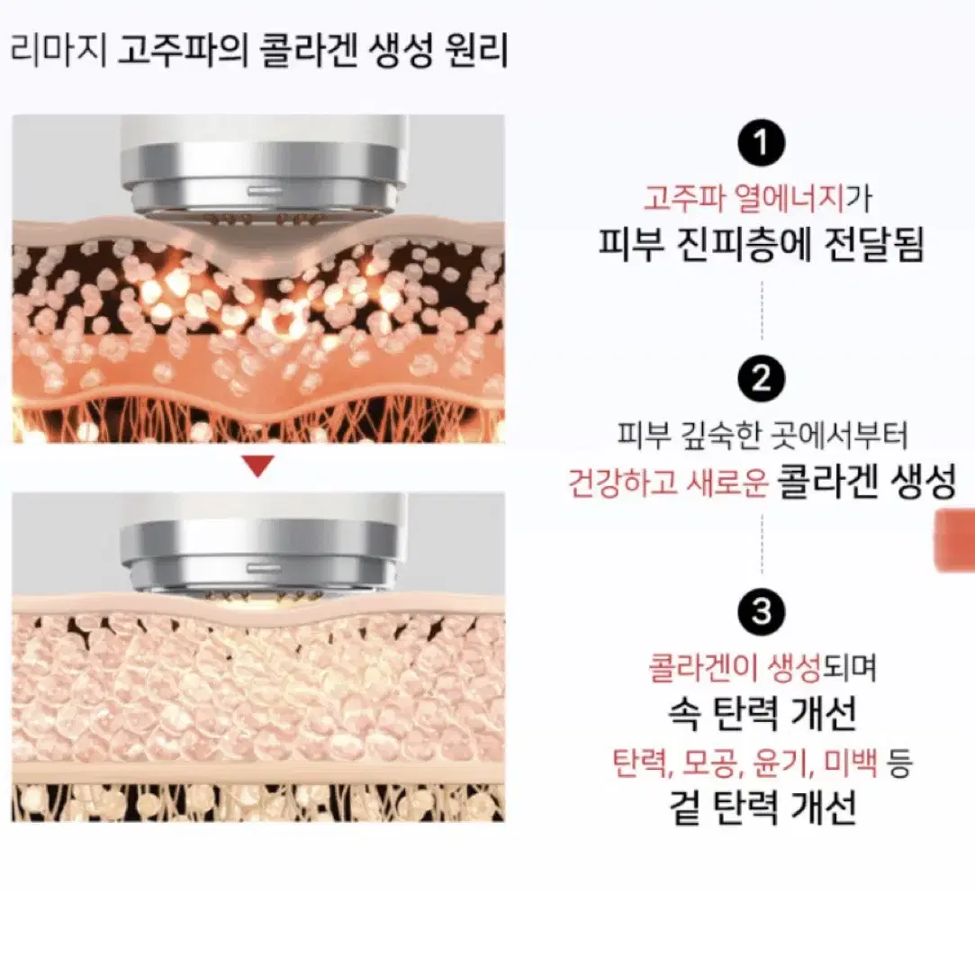 리클레어 리마지 고주파기기