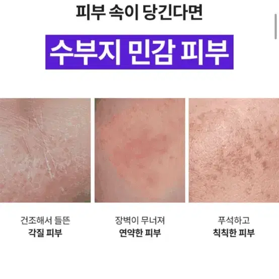 (새상품) 스킨앤랩 베리어덤 링거 앰플 30ml