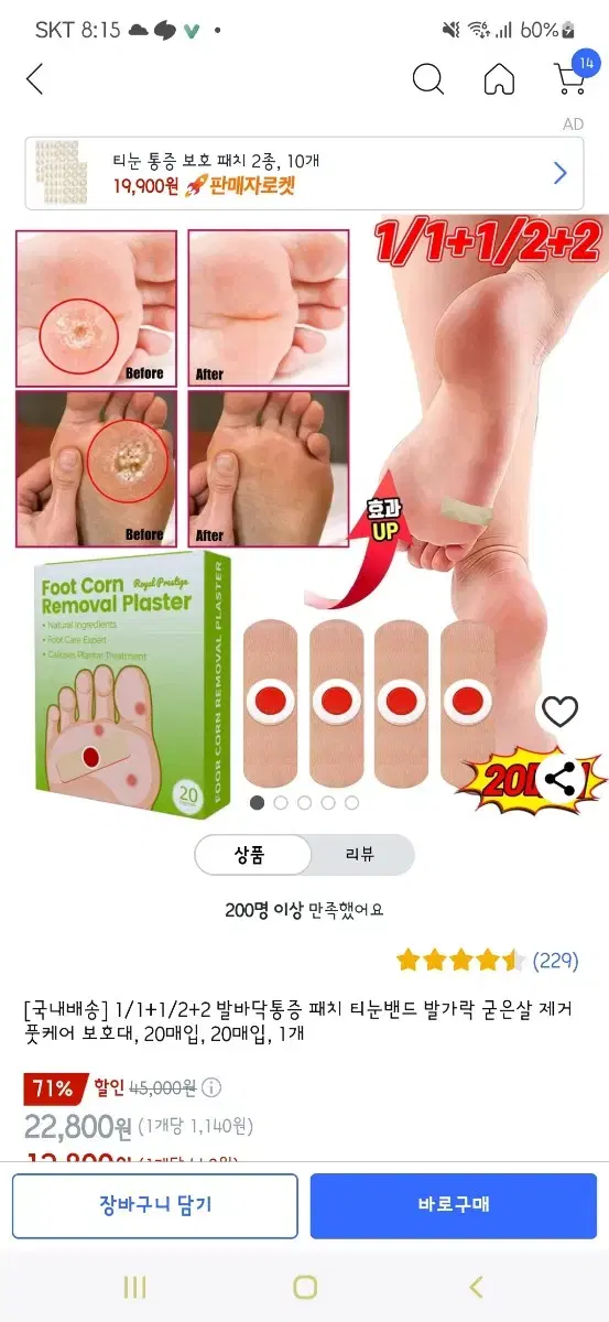 티눈 패치