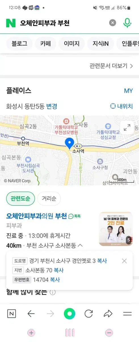 부천 오체안피부과 pdt스켈링1회 , 스켈링2회 양도합니다