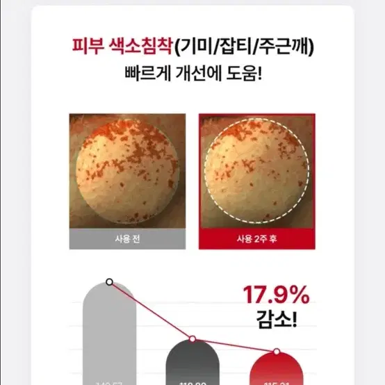 라비엘 아세로라 잡티 앤 기미 케어 스킨&앰플