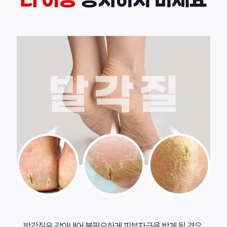 발각질 제거기 굳은살 제거