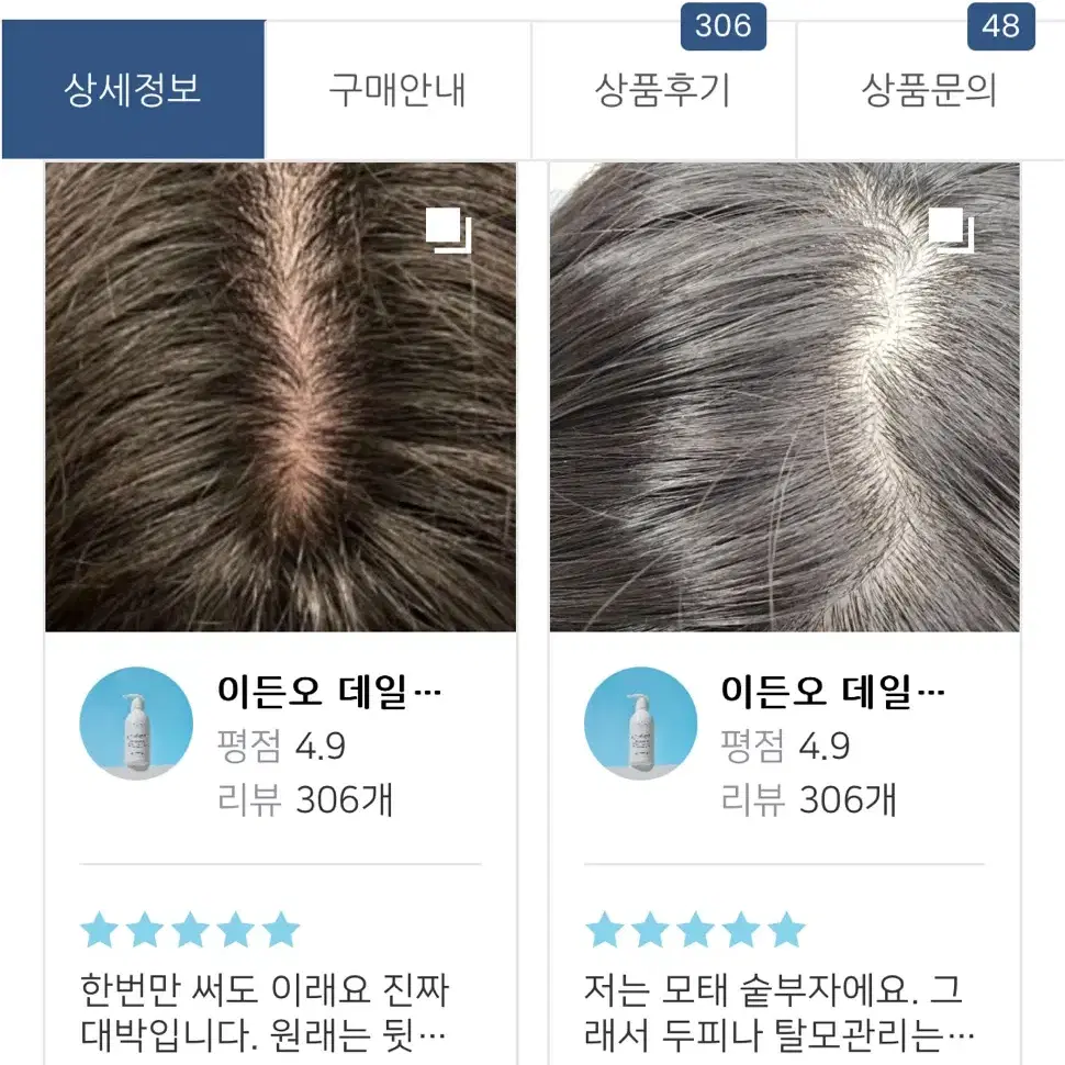 스케일링샴푸 두피각질 비듬 없애주기 탈모 두피관리 모발 가르마 두피팩