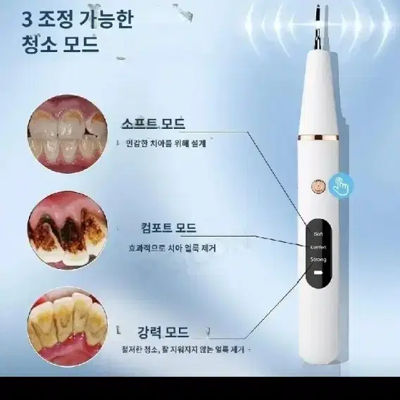 (긴급 떨이판매)치아 관리 치석 제거 하얀 이빨 관리