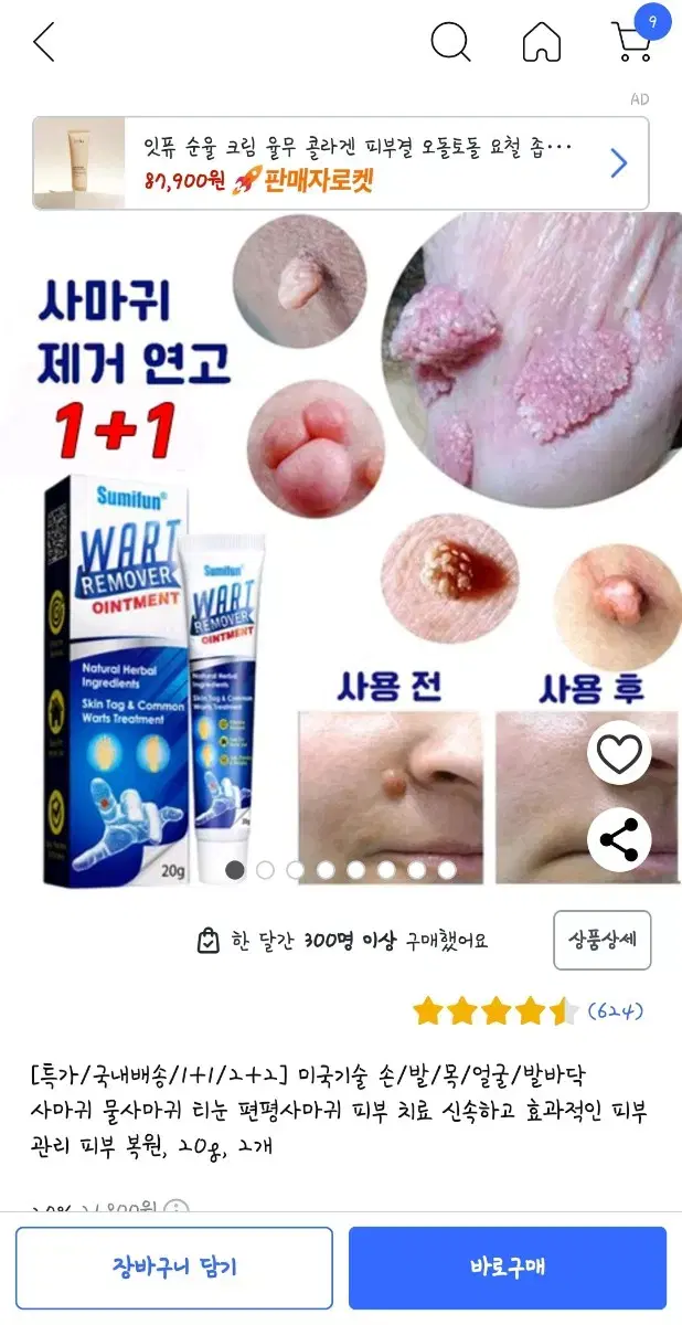 사마귀제거연고.비립종패치 새상품