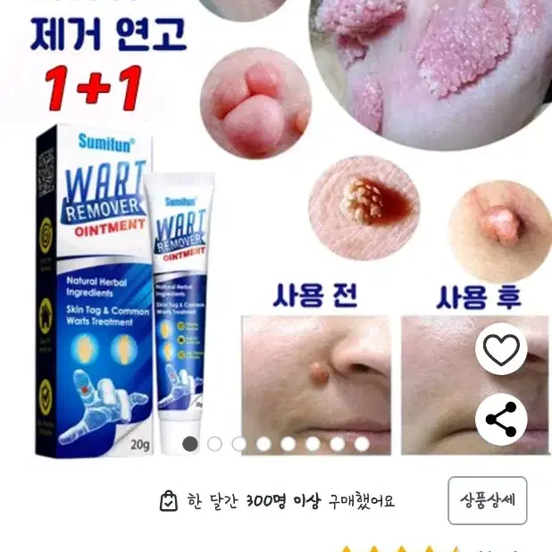 피부 사마귀제거연고.비립종패치 새상품