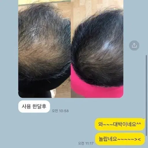 인셀덤 샴푸 (탈모/기능성샴푸)